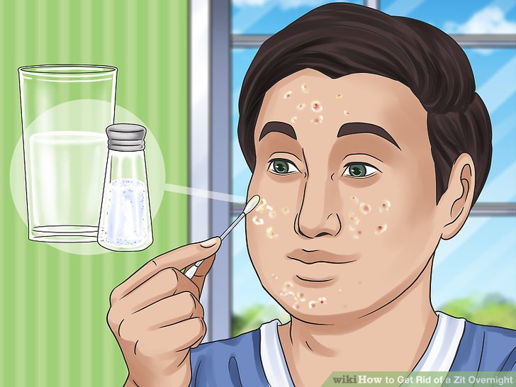 How to Get Rid of a Zit Overnight: Expert-Approved At-Home Remedies