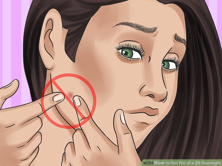 How to Get Rid of a Zit Overnight: Expert-Approved At-Home Remedies